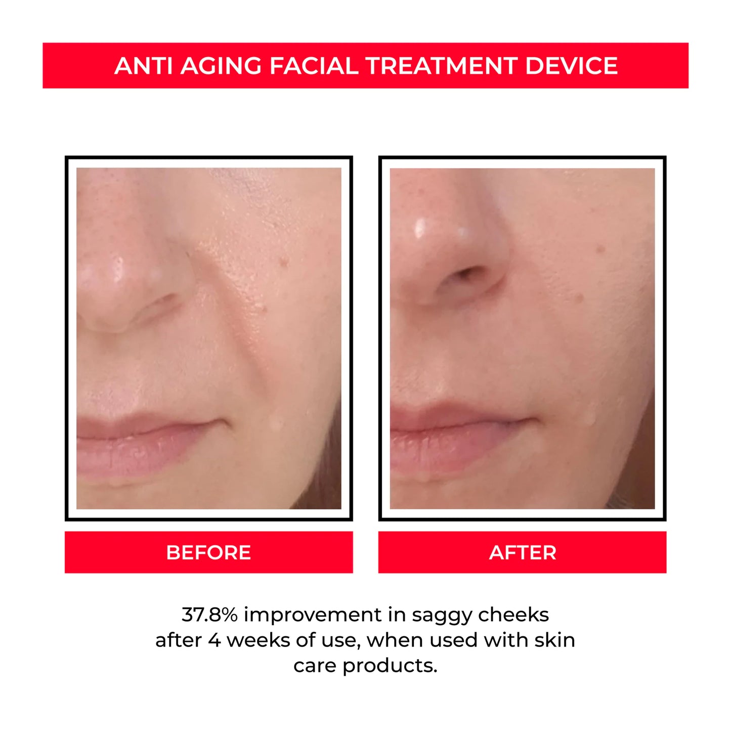 Luzfirme™ Lift Pro – Microcurrent Facial Sculpting Wand