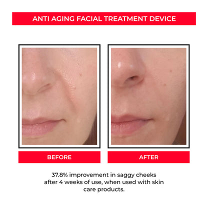 Luzfirme™ Lift Pro – Microcurrent Facial Sculpting Wand
