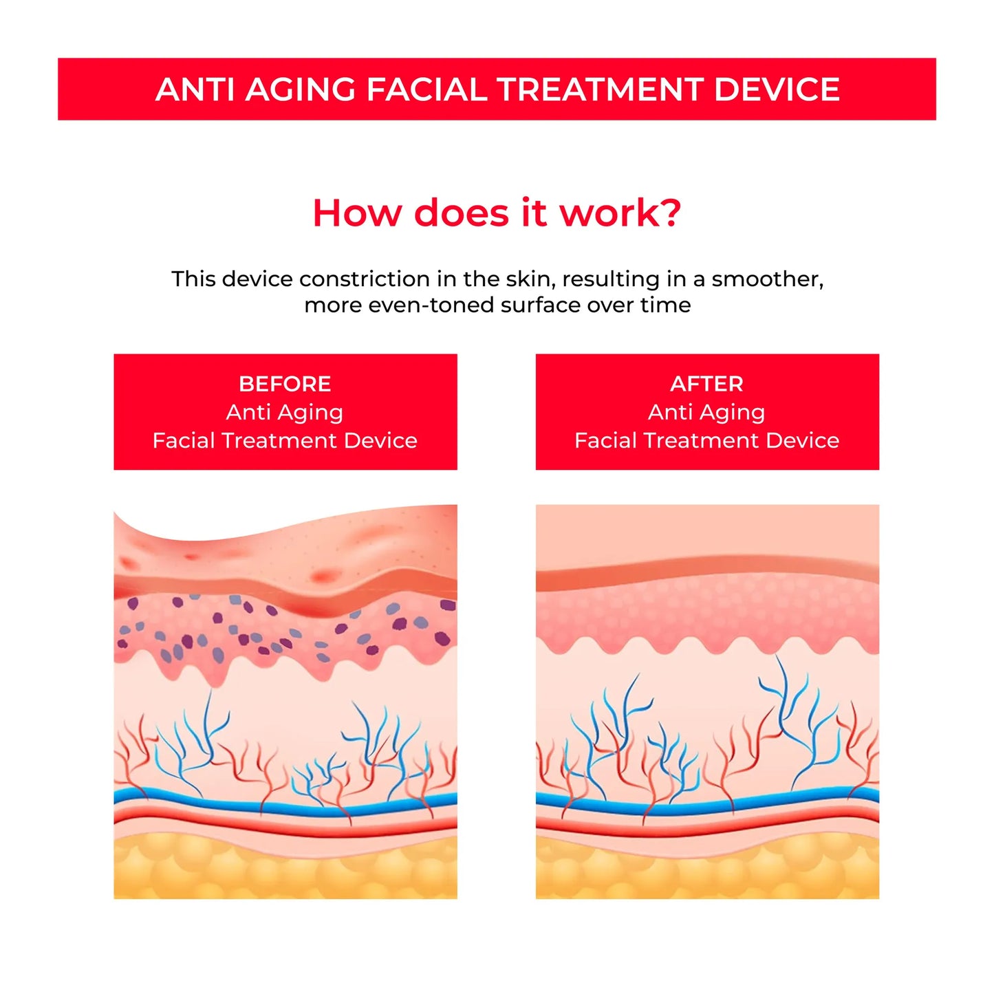 EMS Skin Rejuvenation Device